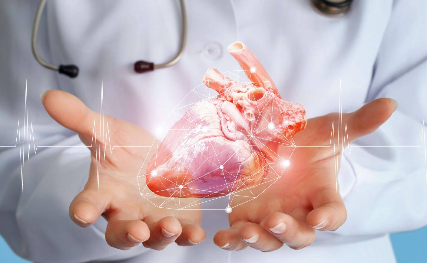 Webinaire Medinect Cardio